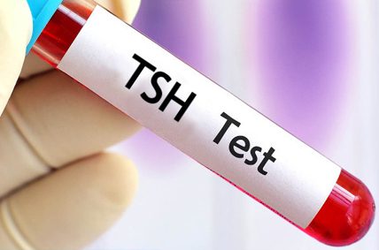 TSH در برگه آزمایش خون چیست؟