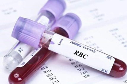 RBC در آزمایش خون