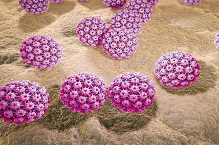پیشگیری و درمان زگیل تناسلی HPV