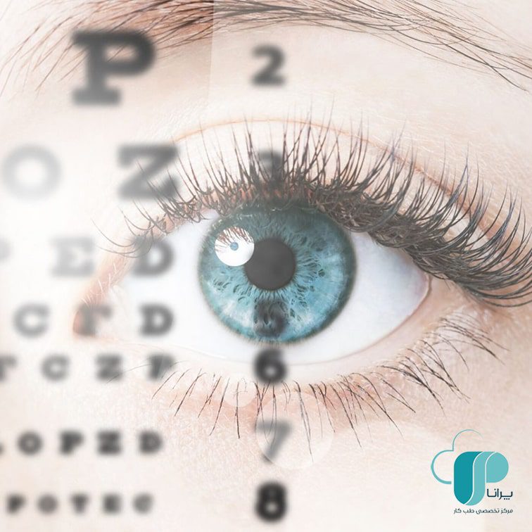 اپتومتری معاینات طب کار پرانا/ بینایی چشم