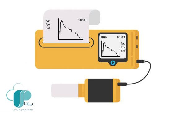 نمودار خروجی تست اسپیرومتری که حجم و سرعت تنفس بیمار را بر حسب زمان نشان می‌دهد
