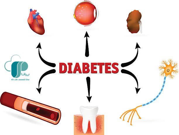اهمیت تشخیص پره دیابت/ پیش دیابت/ درمان دیابت/ آزمایش قند خون/ معاینات دوره ای