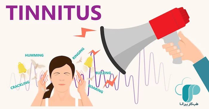 Tinnitus-طب کار پرانا