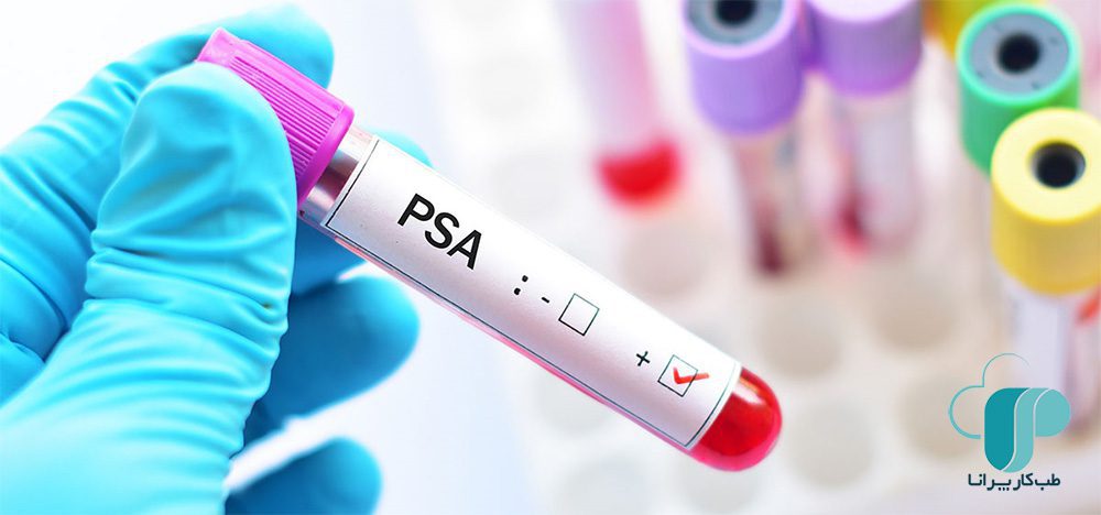 آزمایش PSA/ تفسیر آزمایش PSA/ طب کار پرانا/ سرطان پروستات/ آزمایشات بدو استخدام . دوره ای