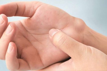 درمان کیست گانگلیون مچ دست/ علت ایجاد کیست مچ دست