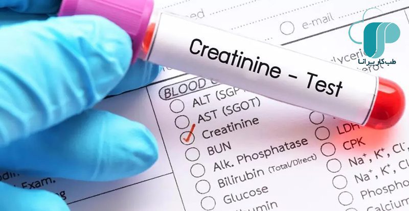 آزمایش کراتینین و اسید اوریک / آزمایش عملکرد کلیه‌ها/ بررسی سلامت کلیه/ آزمایش کلیه/ بیماری نقرس/ آزمایش اوریک اسید/ علت بالا بودن کراتینین در خون چیست؟
