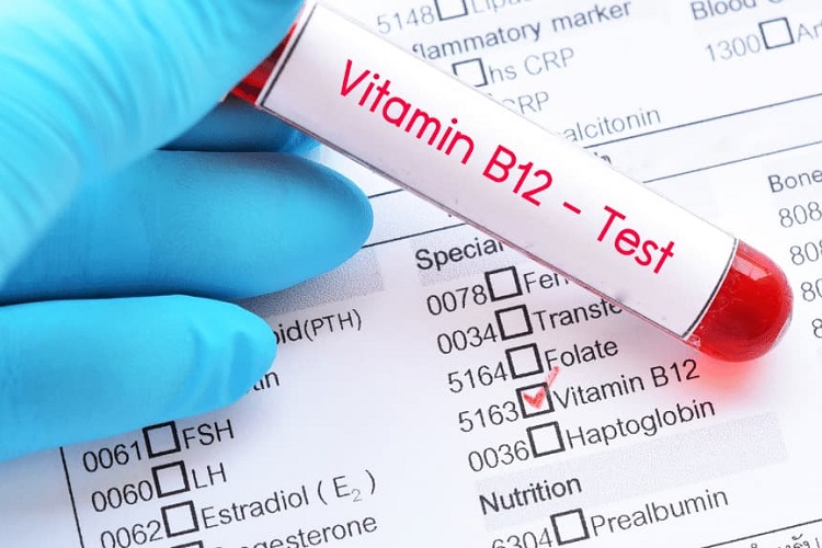 پیشگیری از کمبود ویتامین B12